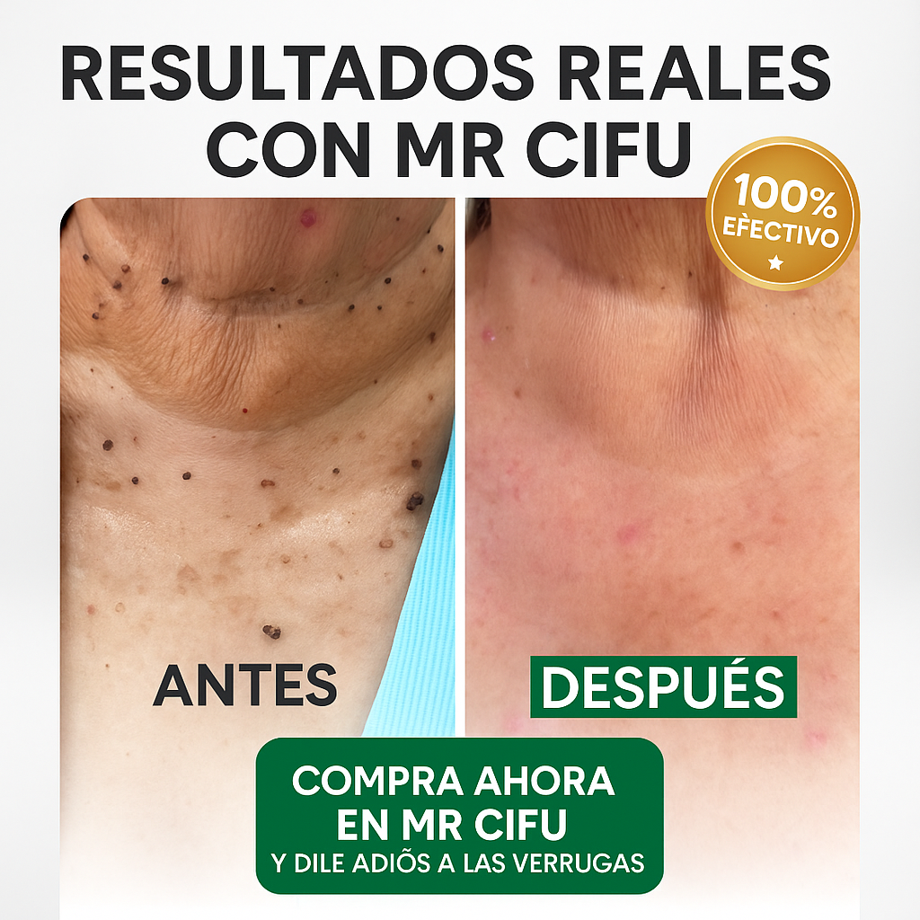 ¿Cansada de sentir vergüenza por esas verrugas? -                               Verruga Off™