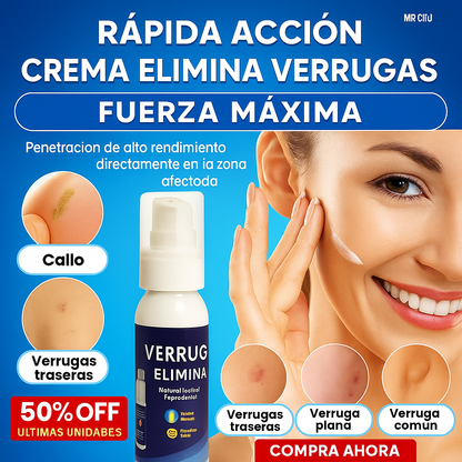 ¿Cansada de sentir vergüenza por esas verrugas? -                               Verruga Off™