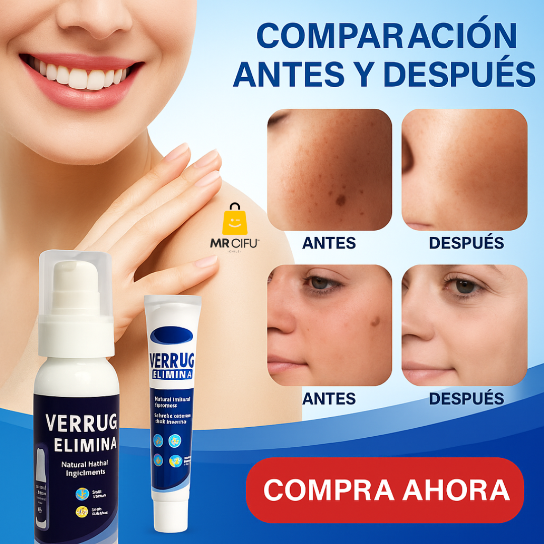 ¿Cansada de sentir vergüenza por esas verrugas? -                               Verruga Off™